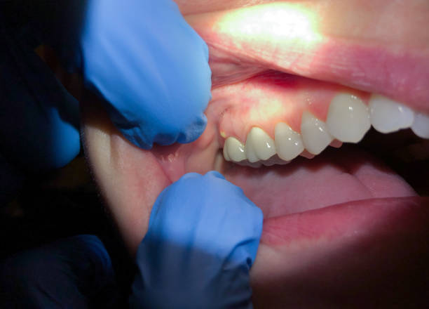 Best Walk-In Emergency Dental Services in Broken Bow, NE